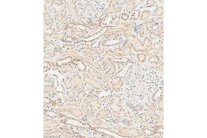 Immunohistochemical analysis of paraffin-embedded human kidney tissue using (ABIN1537780 and ABIN2848638) performed on the Leica® BOND RXm. (RAB28 Antikörper  (AA 119-147))