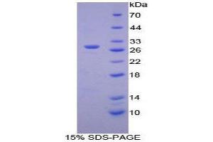SDS-PAGE (SDS) image for Hexosaminidase A (HEXA) (AA 319-528) protein (His tag) (ABIN1879448)
