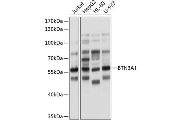 BTN3A1 Antikörper  (AA 40-250)