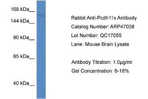 Western Blotting (WB) image for anti-Protocadherin 11 (PCDH11) (Middle Region) antibody (ABIN2782817) (PCDH11X Antikörper  (Middle Region))