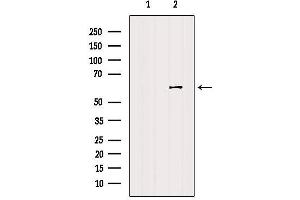 Western Blotting (WB) image for anti-Cell Division Cycle 25 Homolog C (S. Pombe) (CDC25C) (Internal Region) antibody (ABIN6260678)