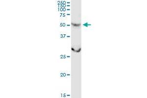 CSGALNACT2 MaxPab rabbit polyclonal antibody. (CSGALNACT2 Antikörper  (AA 1-542))