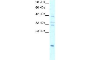WB Suggested Anti-NFKBIA Antibody Titration:  0. (NFKBIA Antikörper  (N-Term))
