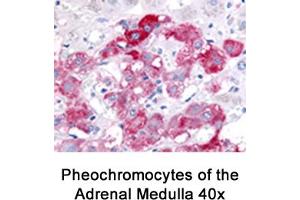 Image no. 2 for anti-Beclin 1, Autophagy Related (BECN1) antibody (ABIN363435) (Beclin 1 Antikörper)