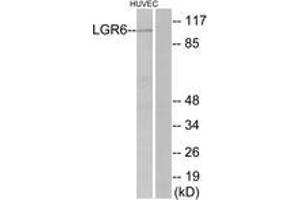 Western blot analysis of extracts from HuvEc cells, using LGR6 Antibody. (LGR6 Antikörper  (AA 471-520))