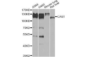 Western blot analysis of extracts of various cell lines, using CAST antibody (ABIN6290228) at 1:1000 dilution. (Calpastatin Antikörper)