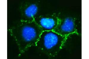 IF analysis of delta 1 Catenin/CAS/CTNND1 using anti-delta 1 Catenin/CAS/CTNND1 antibody (ABIN7602221). (CTNND1 Antikörper  (AA 64-930))