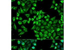 Immunofluorescence analysis of A549 cells using ABAT Polyclonal Antibody (ABAT Antikörper)