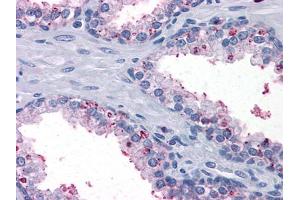 Immunohistochemistry (IHC) image for anti-3-hydroxybutyrate Dehydrogenase, Type 1 (BDH1) antibody (ABIN1724721)