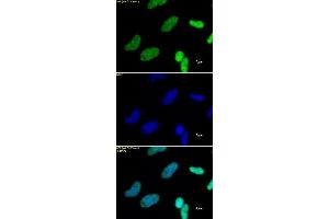 Histone H3K27me3 antibody (pAb) tested by immunofluorescence. (Histone 3 Antikörper  (H3K27me3))