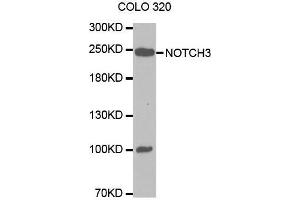 Western blot analysis of extracts of COLO 320 cells lines, using NOTCH3 antibody. (NOTCH3 Antikörper  (AA 751-850))