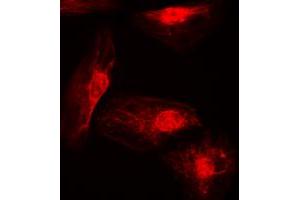 Immunofluorescent analysis of IRF4 staining in A549 cells.