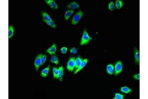 Immunofluorescent analysis of HepG2 cells using ABIN7170223 at dilution of 1:100 and Alexa Fluor 488-congugated AffiniPure Goat Anti-Rabbit IgG(H+L) (SLC35B1 Antikörper  (AA 106-135))