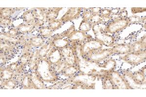 Immunohistochemistry (IHC) image for anti-Tenascin C (TNC) (AA 513-621) antibody (ABIN7434452)