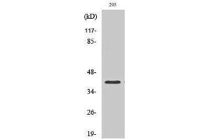 Western Blotting (WB) image for anti-Mitogen-Activated Protein Kinase Kinase 4 (MAP2K4) (C-Term) antibody (ABIN3186893) (MAP2K4 Antikörper  (C-Term))