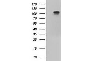 HEK293T cells were transfected with the pCMV6-ENTRY control (Left lane) or pCMV6-ENTRY USP5 (Right lane) cDNA for 48 hrs and lysed. (USP5 Antikörper)