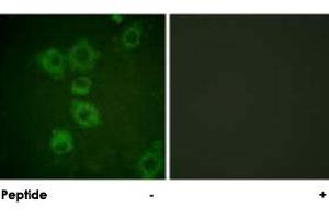 Immunofluorescence analysis of HUVEC cells, using CASP6 polyclonal antibody . (Caspase 6 Antikörper)