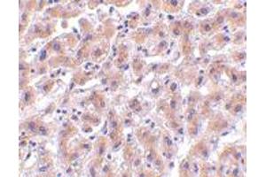 Immunohistochemistry of HTRA2 in human liver tissue with HTRA2 polyclonal antibody  at 2 ug/mL . (HTRA2 Antikörper  (C-Term))