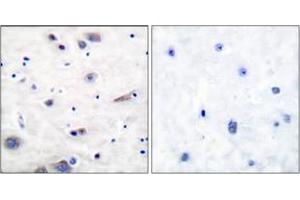 Immunohistochemistry analysis of paraffin-embedded human brain, using SHP-2 (Phospho-Tyr580) Antibody.