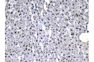 IHC analysis of VEGF Receptor 3 using anti-VEGF Receptor 3 antibody . (FLT4 Antikörper)