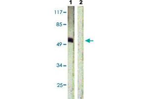 Western blot analysis of Lane 1: HepG2 cells, Lane 2: antigen-specific peptide treated HepG2 cells with ETS1 (phospho T38) polyclonal antibody  at 1:500-1:1000 dilution.