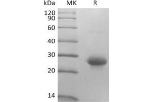 Western Blotting (WB) image for CD70 Molecule (CD70) protein (His tag) (ABIN7320908) (CD70 Protein (His tag))