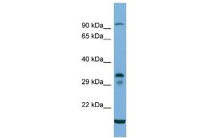 Host:  Rabbit  Target Name:  TM6SF2  Sample Type:  293T Whole cell lysates  Antibody Dilution:  1.