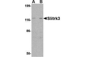 Western blot analysis of Slitrk3 in SK-N-SH cell lysate with AP30802PU-N Slitrk3 antibody at (A) 0.