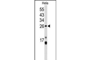 Western blot analysis of CENPH Antibody (Center) (ABIN653160 and ABIN2842728) in Hela cell line lysates (35 μg/lane). (CENPH Antikörper  (AA 136-162))