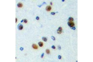Immunohistochemical analysis of NPAS4 staining in human brain formalin fixed paraffin embedded tissue section. (NPAS4 Antikörper  (C-Term))