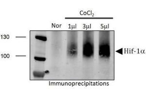 Image no. 5 for anti-Hypoxia Inducible Factor 1, alpha Subunit (Basic Helix-Loop-Helix Transcription Factor) (HIF1A) (AA 432-528) antibody (ABIN363317) (HIF1A Antikörper  (AA 432-528))