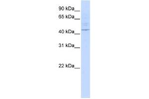 WB Suggested Anti-LAX1 Antibody Titration:  0. (LAX1 Antikörper  (Middle Region))