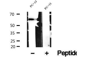 Western blot analysis of extracts of PC-13 cells, using SMOX antibody. (SMOX Antikörper  (Internal Region))