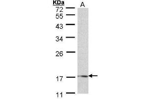 WB Image Sample (30 ug of whole cell lysate) A: 293T 12% SDS PAGE antibody diluted at 1:500 (LMO1 Antikörper)