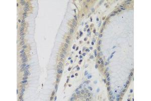 Immunohistochemistry of paraffin-embedded Human stomach using CCL26 Polyclonal Antibody at dilution of 1:200 (40x lens). (CCL26 Antikörper)