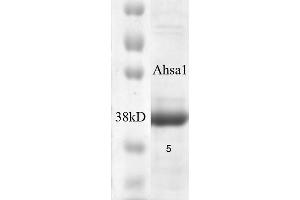 SDS-PAGE of native human 38 kDa Aha1 protein (ABIN1686714, ABIN1686715 and ABIN1686716).