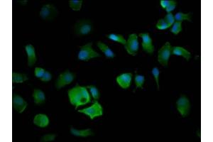 Immunofluorescence staining of MCF-7 cells with ABIN7151584 at 1:200, counter-stained with DAPI. (ELP4 Antikörper  (AA 117-223))