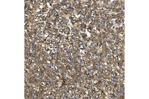 IHC analysis of PDE6 beta/PDE6B using anti-PDE6 beta/PDE6B antibody (ABIN7600894). (PDE6B Antikörper  (AA 25-237))