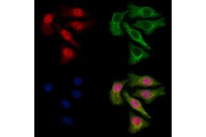 anti-Wolf-Hirschhorn Syndrome Candidate 2 (WHSC2) (Internal Region) antibody