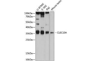 Western blot analysis of extracts of various cell lines, using CD301/CLEC10A antibody (ABIN6130073, ABIN6138696, ABIN6138697 and ABIN6215492) at 1:1000 dilution. (CLEC10A Antikörper  (AA 60-180))