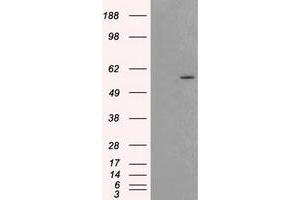 HEK293T cells were transfected with the pCMV6-ENTRY control (Left lane) or pCMV6-ENTRY AKT2 (Right lane) cDNA for 48 hrs and lysed. (AKT2 Antikörper)