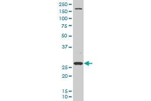 Western Blotting (WB) image for anti-Defective in Cullin Neddylation 1, Domain Containing 1 (DCUN1D1) (AA 1-89) antibody (ABIN565718)