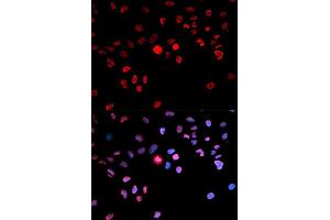 Immunofluorescence analysis of MCF7 cell using Phospho-CREB1-S133 antibody. (CREB1 Antikörper  (pSer133))