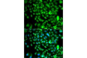 Immunofluorescence analysis of  cells using CSRP2BP antibody (ABIN6127664, ABIN6139138, ABIN6139139 and ABIN6223242).
