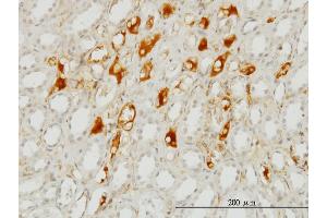 Immunostaining (ISt) image for anti-Serpin Peptidase Inhibitor, Clade G (C1 Inhibitor), Member 1 (SERPING1) (AA 1-500) antibody (ABIN513846)