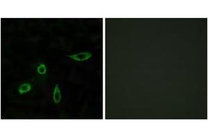 Immunofluorescence analysis of LOVO cells, using EDG4 Antibody. (EDG4 Antikörper  (AA 290-339))