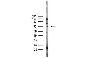 anti-Metastasis Associated 1 Family, Member 3 (MTA3) (Internal Region) antibody