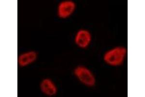 ABIN6275131 staining HepG2 by IF/ICC. (FOXN4 Antikörper  (C-Term))