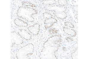 Immunohistochemistry (IHC) image for anti-Kruppel-Like Factor 4 (Gut) (KLF4) (AA 75-125) antibody (ABIN7795639)