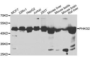 Western blot analysis of extracts of various cell lines, using PHKG2 antibody. (PHKG2 Antikörper  (AA 237-406))
